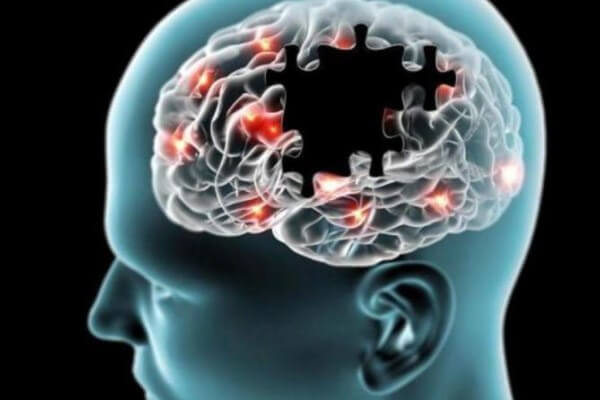 Quais são as causas do mal de Alzheimer? Veja aqui.