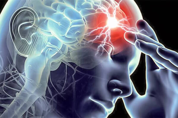 Prevenindo o AVC: 5 Atitudes para evitar o derrame cerebral