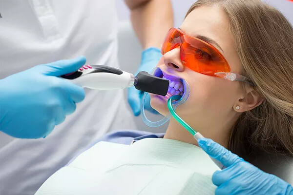 clareamento dental laser