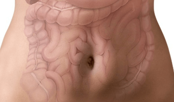 Qualidade de Vida: Cirurgia De Diverticulite É Perigosa? Leia Mais Aqui!