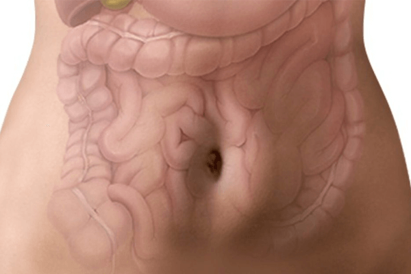 Cirurgia De Diverticulite É Perigosa? Leia Mais Aqui! 