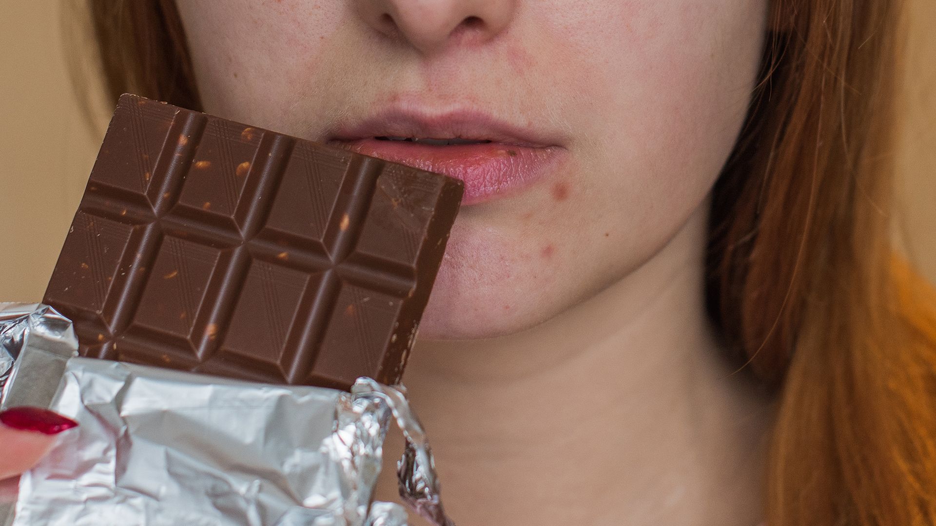 Chocolate causa mesmo acne? Acabe de vez com a dúvida 